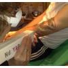 Destock Discount yag 08 indispensable laser efficace en studio de tatouages